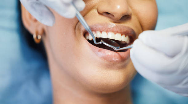 Best Chipped Tooth Repair Near Me  in Buhl, ID